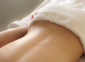 Acupuncture Ft Lauderdale - Best, Latest, Pain, Fertility, Menopause, Nutrition